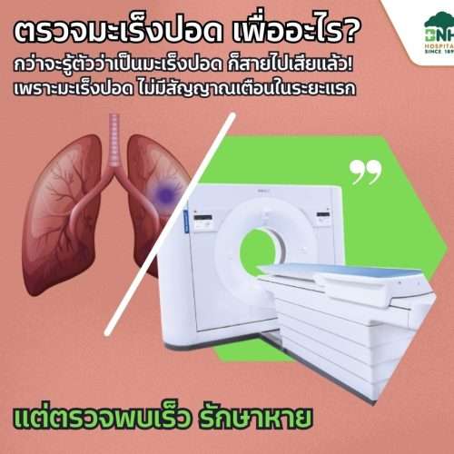 Alternative view of ตรวจคัดกรองมะเร็งปอดด้วยเอกซเรย์คอมพิวเตอร์รังสีต่ำ Low-dose CT Scan โดย โรงพยาบาลบีเอ็นเอช BNH Hospital