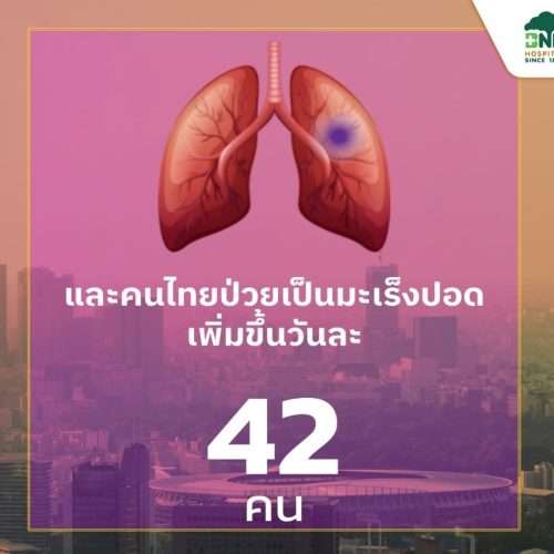 ตรวจคัดกรองมะเร็งปอดด้วยเอกซเรย์คอมพิวเตอร์รังสีต่ำ Low-dose CT Scan โดย โรงพยาบาลบีเอ็นเอช BNH Hospital - Image 4