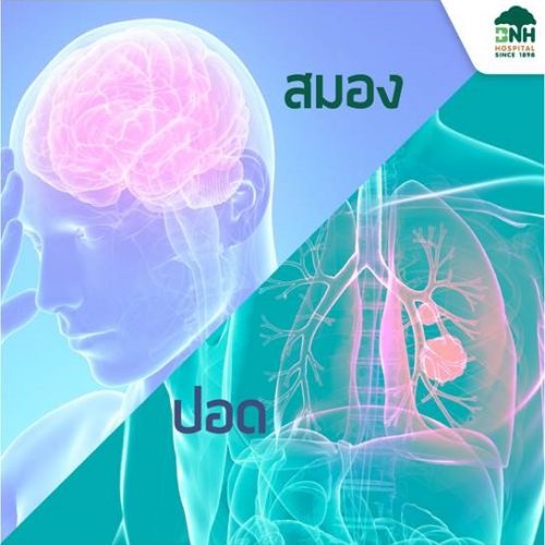 Alternative view of แพ็กเกจตรวจ สมอง ปอด