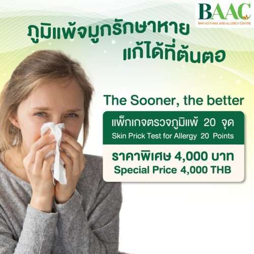Skin Prick Test for Allergy 20 points